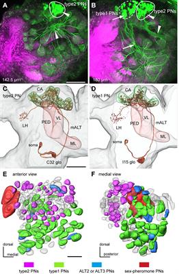 Two Parallel Olfactory Pathways for Processing General Odors in a Cockroach